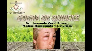 Facial y es que palpebral edema