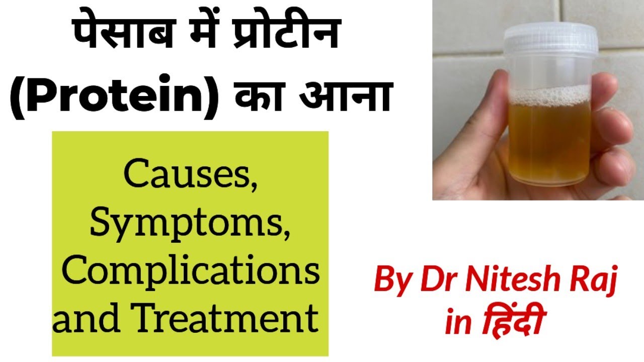 Treatment of protein in urine - #drniteshraj.Albuminuria,treatment of microalbuminuria