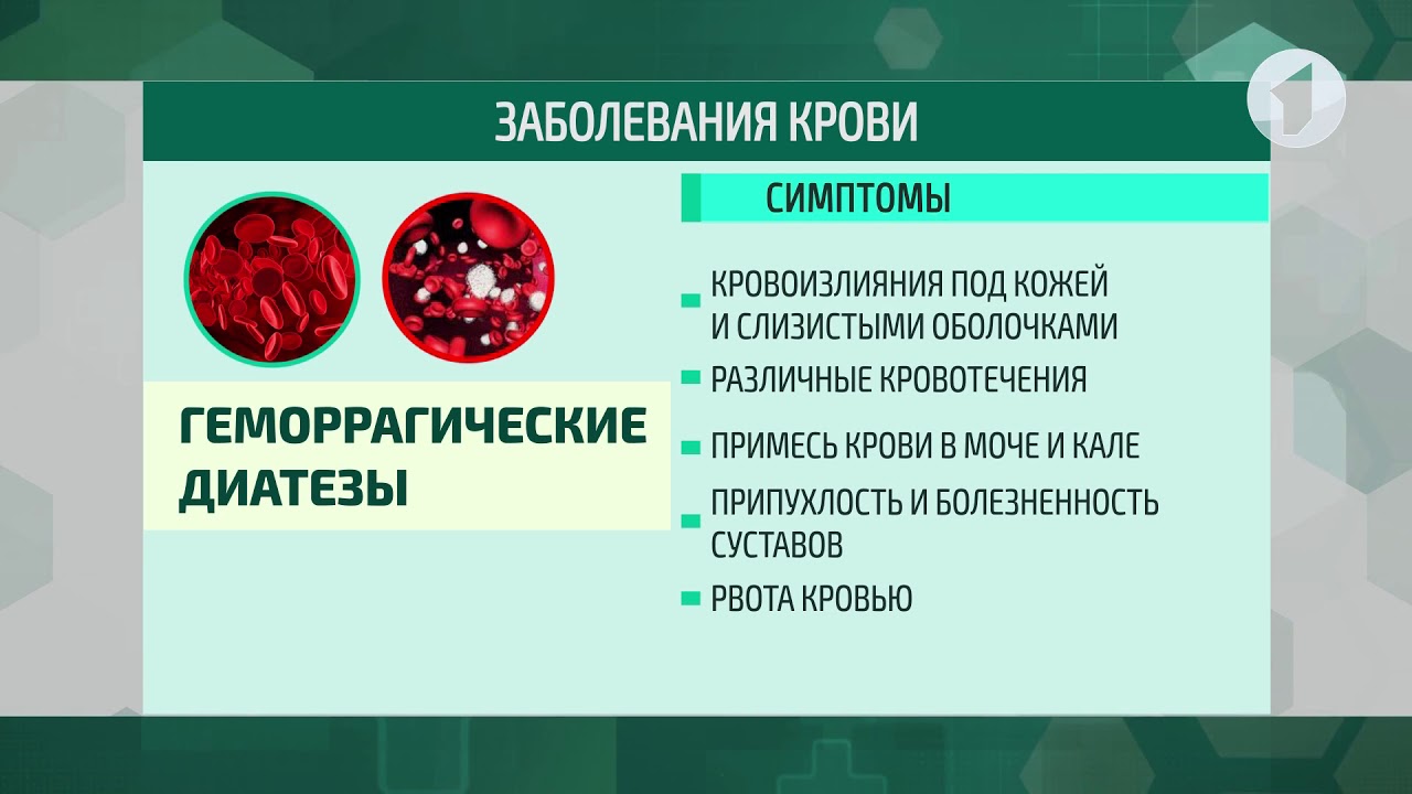 Причины нарушения крови. Классификация болезней крови. Патологии заболевания крови. Классификация болезней системы крови.