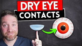 Best Contact Lenses For Dry Eyes (2023)