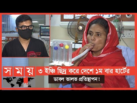 ভিডিও: প্রথম নেওয়ার সময় সর্বোচ্চ কে প্রতিস্থাপন করছে?