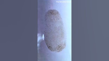 Become a Detective at Home😱|| The EchoNarratives|| #shorts