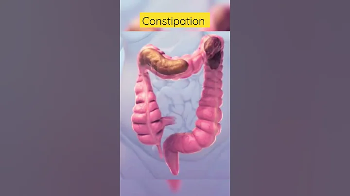 This is how constipation looks inside #viral #shortsvideo - DayDayNews