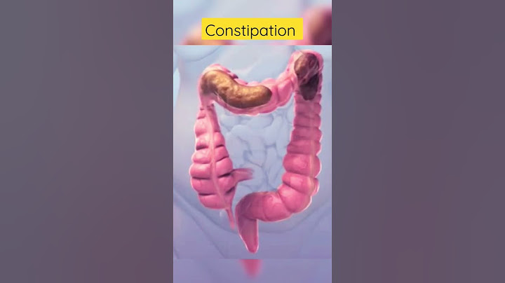 This is how constipation looks inside #viral #shortsvideo