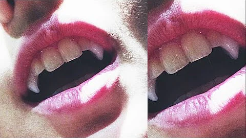Quanto costa rimodellare i denti?