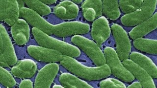4 dead from flesh-eating bacteria in Florida Four People Dead From Flesh Eating Bacteria In Florida