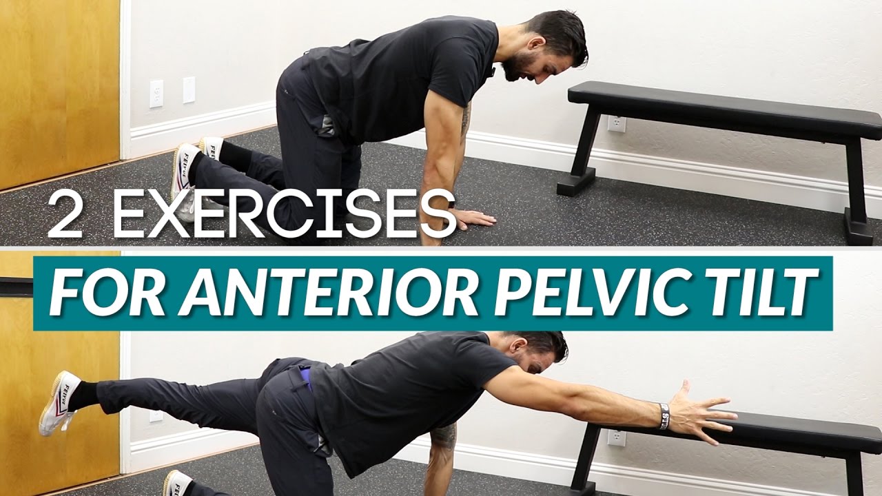 Best Exercises For Anterior Pelvic Tilt Exercise Poster