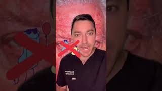 Eyebrow Dandruff how does it happen? - TikTok SkinDoc