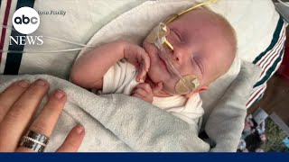 Doctors saved baby's life with gene fix for deadly rare disease