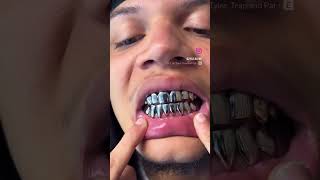 ZYLO BLYNK COPS WHITE GOLD GRILLS