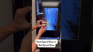 Good Disc Vs Bad Disc