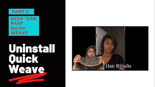 Uninstall Quick Weave | Using Hair Protectant | Part 2 Deep Side Part Quick Weave #DIY #QuickWeave