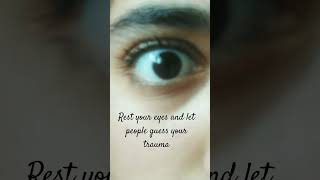 Rest your eyes and let people guess your trauma