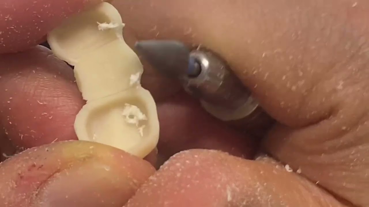 14-16 현실템포 스피드 임시치아 조각 temporary crown