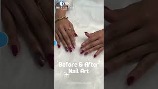 ✨ Nail Transformation Magic! 💅 | Before & After Nail Art by RK Skin & Hair Studio 🌟