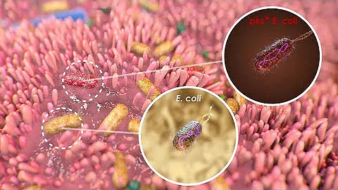 Mutational Signature in Colorectal Cancer caused by Genotoxic pks+ E. coli - DayDayNews