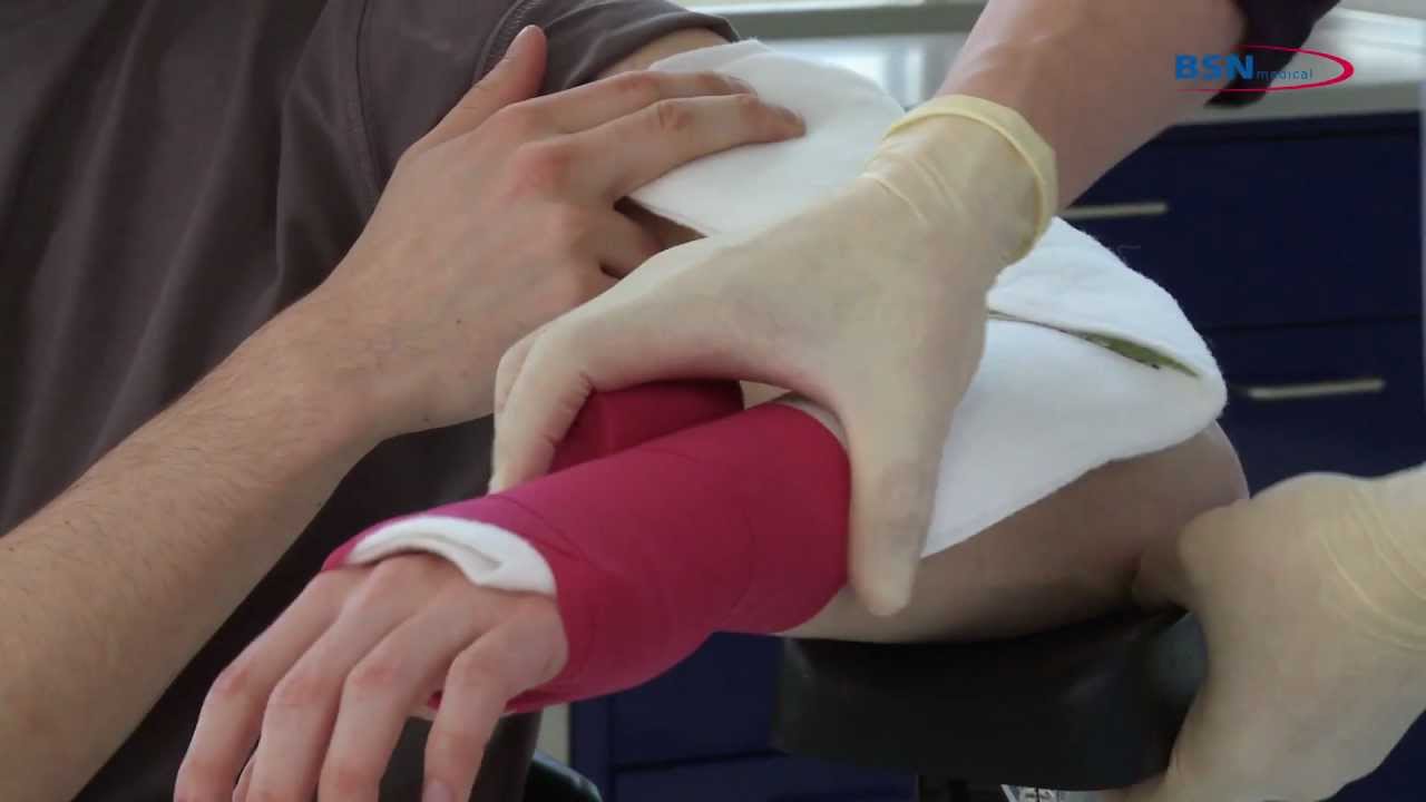 Dorsolaterale Ellbogenschiene nach Fraktur_DE_von BSN medical.mov - YouTube