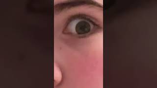 Sevdiğimiz Kişiyi Düşürken Göz Bebeğimiz Büyüyormuş🥹