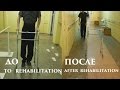 Реабилитация. УСПЕХ. Before and After Rehabilitation.