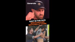 Shot In The Face While The Camera Rolled