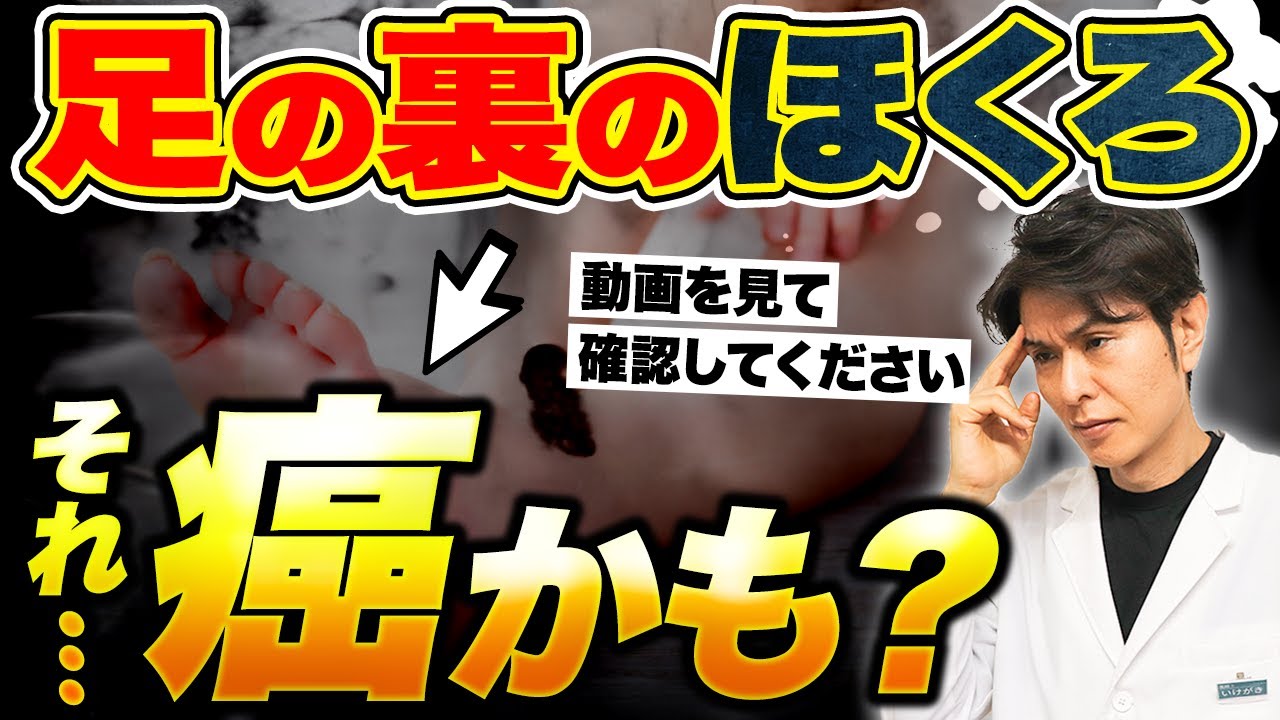 足 裏 ほくろ 癌 見分け 方