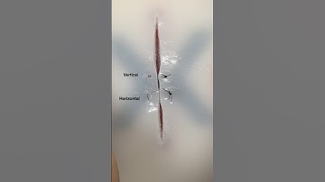 Vertical Mattress Suture #surgicalskills #suturing #surgery #surgeon #medicine