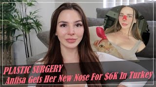 Plastic Surgery 90 Day Fiance Anfisa Arkhipchenko Gets Her New Nose For 6K In Turkey