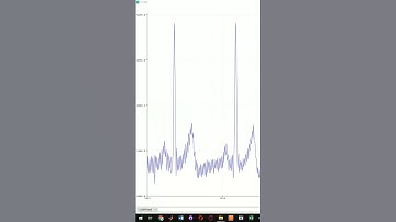 Sensor Keyes AD8232 + ESP32 ADC Signal Sampling 10 mS #shorts #short