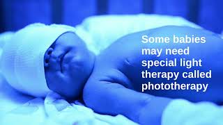 Jaundice in newborns:what parents need to know by TMC Health 393 views 10 months ago 3 minutes, 6 seconds