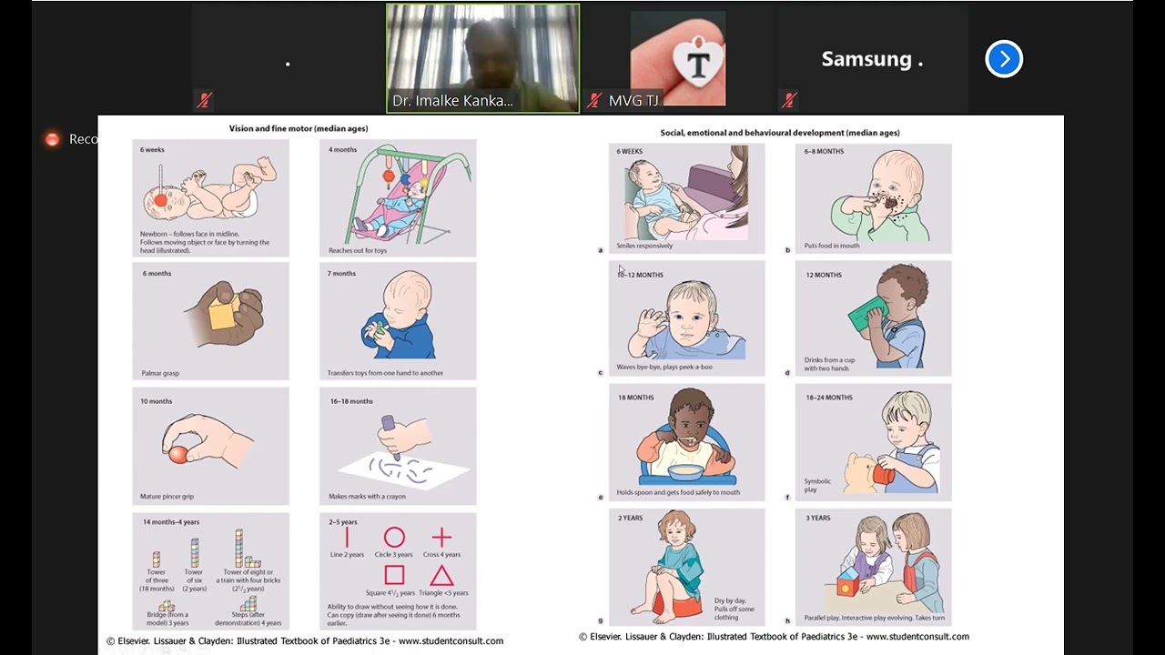 Paediatric short Cases Abdomen, CNS, Development by Dr. Imalke Kankananarachchi