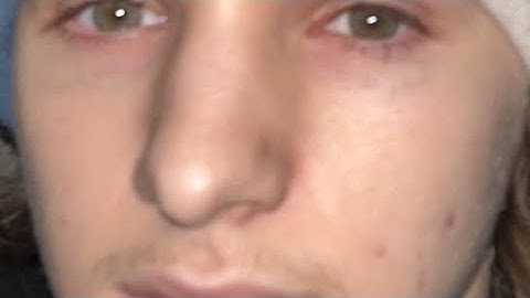 I’m calling an admin