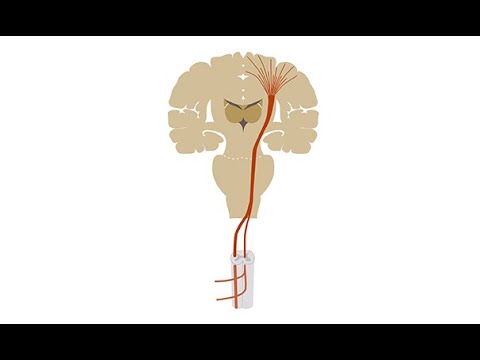 Video: Sklerosis Lateral Amyotrophic: Gejala, Rawatan, Sebab, Diagnosis
