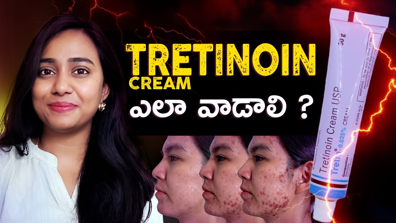 How To Use Tretinoin Cream In Telugu  | Tretinoin Cream Ela Vaadali |Best Beautys