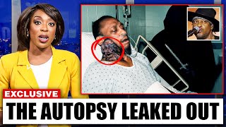 D'Angelo's Last Secret Revealed By The Doctor, And It Will Haunt You