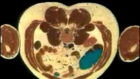 The Making of the Visible Human Project