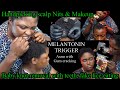 ASMR✨hand picking hair crust, make up application , baby knot loosening with teeth, scalp scratching