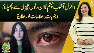 Viral Conjunctivitis is rapidly spreading these days - Causes, Symptoms, and Treatment -Aaj Pakistan
