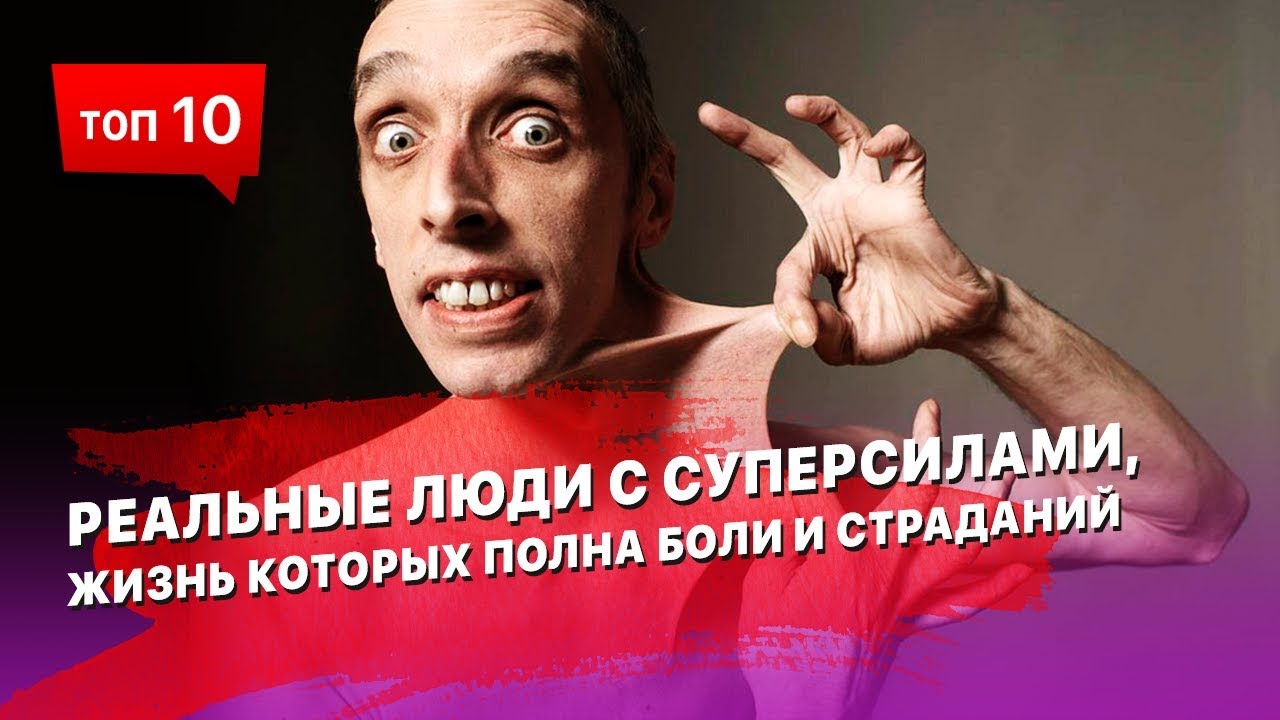 Топ-10: реальные люди с суперсилами, жизнь которых полна боли и страданий Топ-10: реальные люди с суперсилами, жизнь которых полна боли и страданий