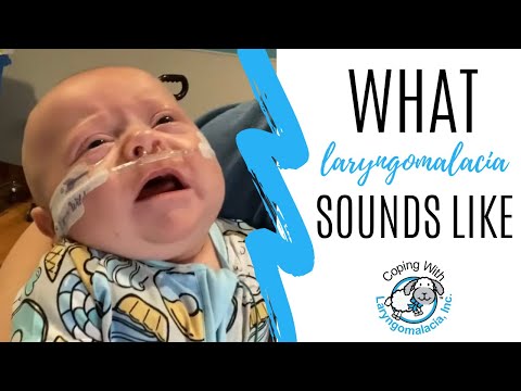 What Laryngomalacia Sounds Like | noisy breathing | newborn congestion