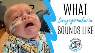 What Laryngomalacia Sounds Like | noisy breathing | newborn congestion screenshot 5
