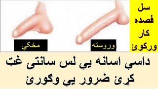 داسې اسانه کوتک یعني غین لس سانتي غټیږي ضرور یې وګورئAfghan Health TV ! Pashto Healht Care
