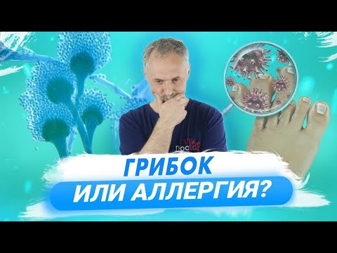 видео: Грибок ногтей и кожи: лечение и профилактика / Доктор Виктор