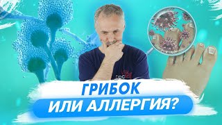 Грибок ногтей и кожи: лечение и профилактика / Доктор Виктор