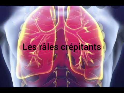 les râles crépitants (pneumonie ou insuffisance cardiaque gauche)# ...