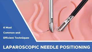 6 Most Common And Efficient Techniques For Laparoscopic Needle Positioning