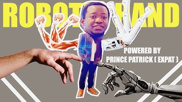 The most advanced prosthetic human arm robot | Easy Trade Africa