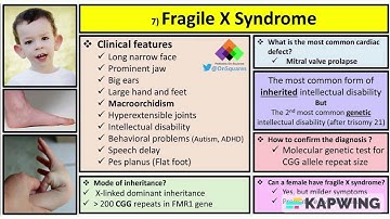 FRAGILE X SYNDROME, CAUSES, CLINICAL FEATURES, RISKS, DIAGNOSIS, MANAGEMENT