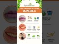 Easy &amp; Natural Self-Care Remedies 🌿 | Lips, Teeth &amp; Breath Care #shortsfeed #viral#shorts#healthy