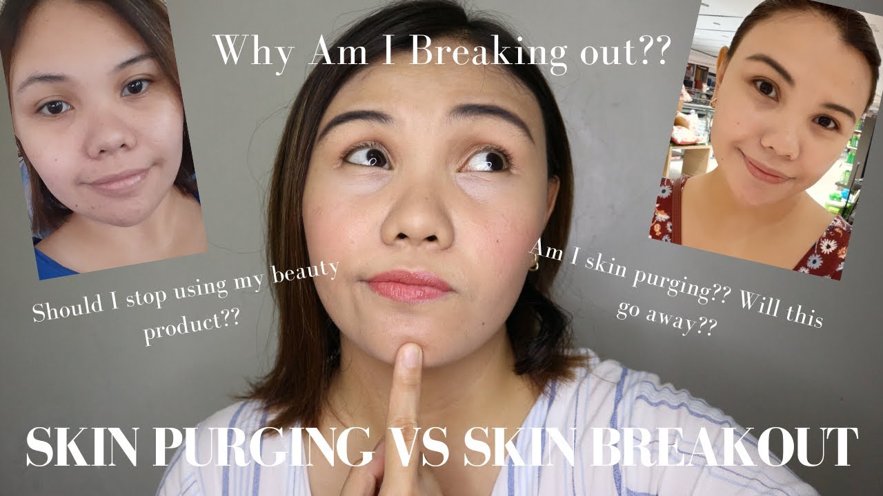 Is My Skin Purging Or Breaking Out? How To Tell If You're Having A Product Reaction | Debbie Gee
