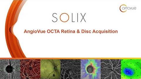 Solix OCTA Acquisition